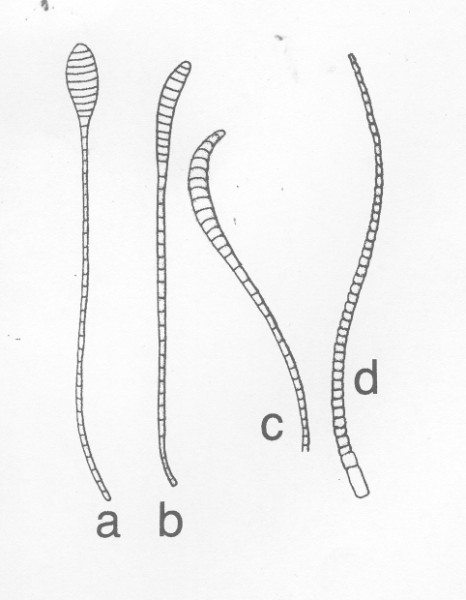 Antennen. a) geknopt. b-c) knotsvormig d) draadvormig.